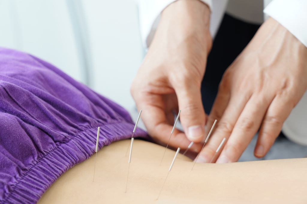 image Acupuncture bienfaits et indications 